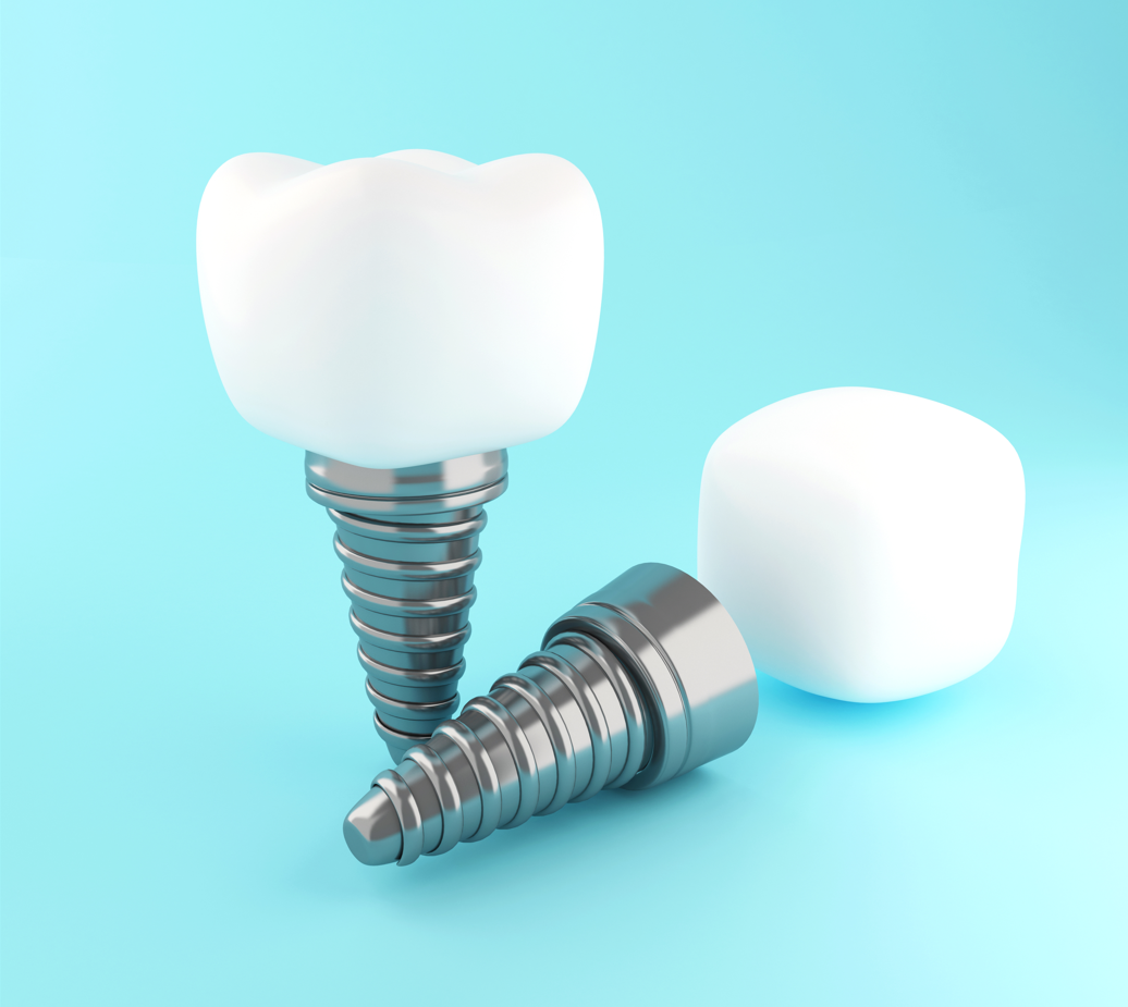 two dental implants on a light blue background. Each implant consists of a metal screw and a white ceramic crown. One implant is standing upright, displaying the crown on top of the screw, while the other is lying on its side.